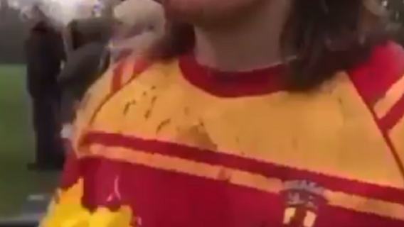 Kontuzja wideo